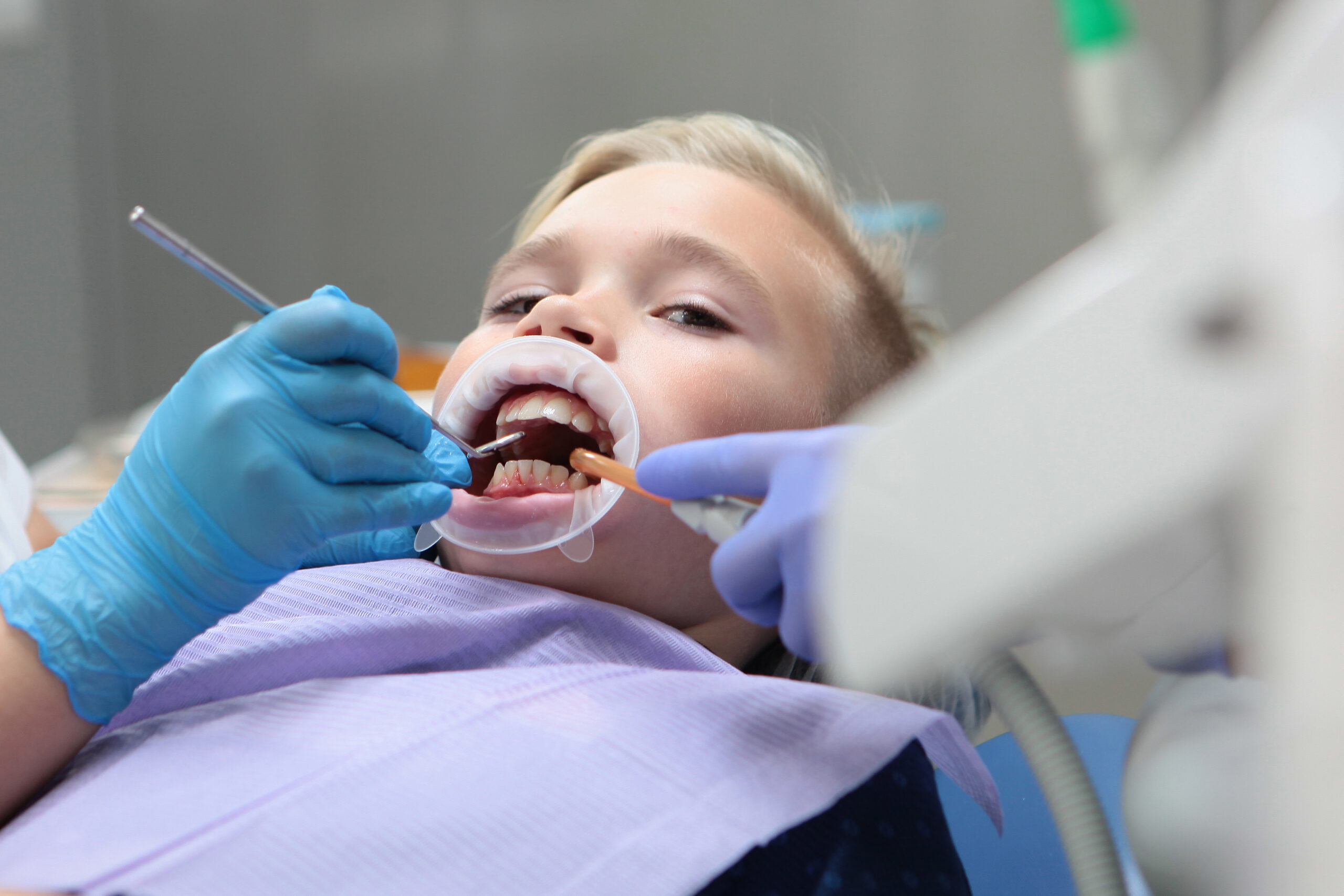 Children's Dental Cleaning